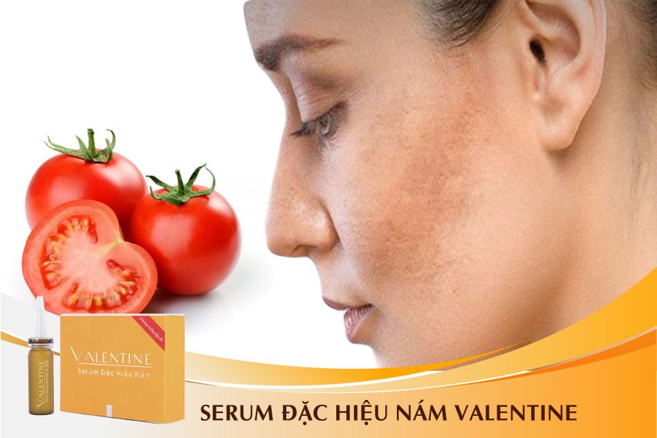 Chữa trị hiệu quả sạm da với cà chua