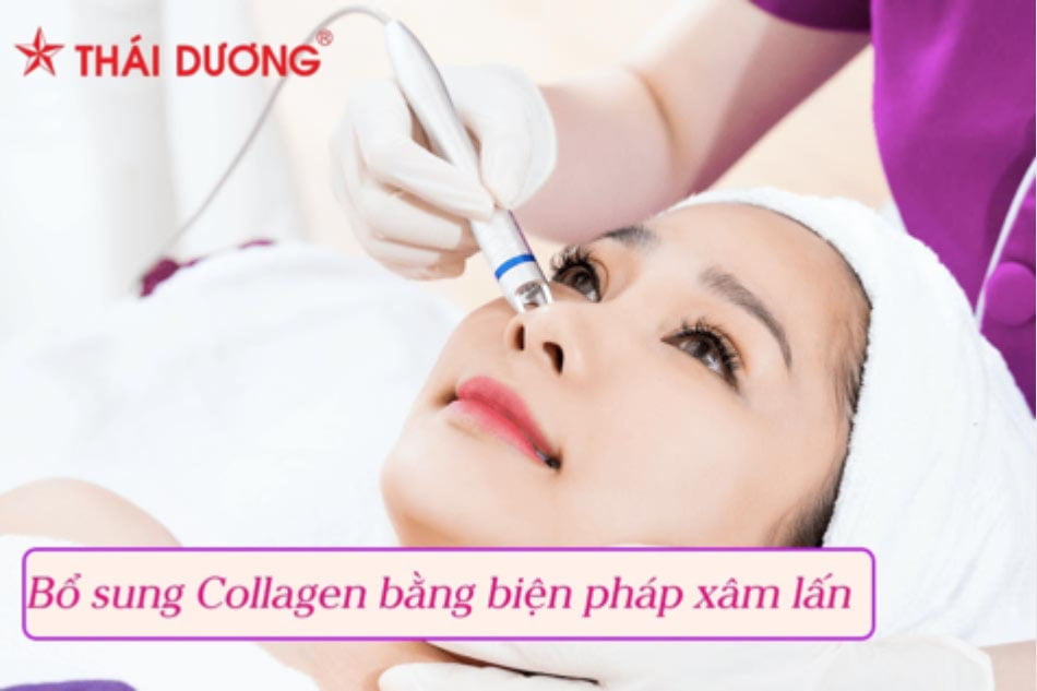 Bổ sung Collagen vùng mắt bằng biện pháp xâm lấn