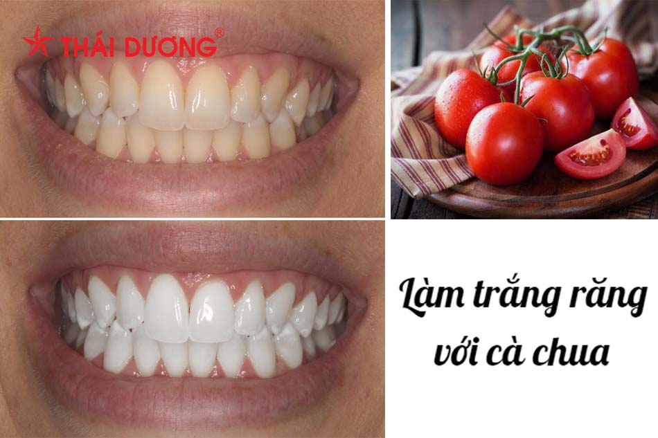 Dùng cà chua làm trắng răng hiệu quả